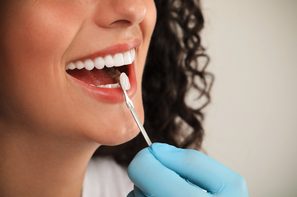 Doctor holding up veneer near smiling woman