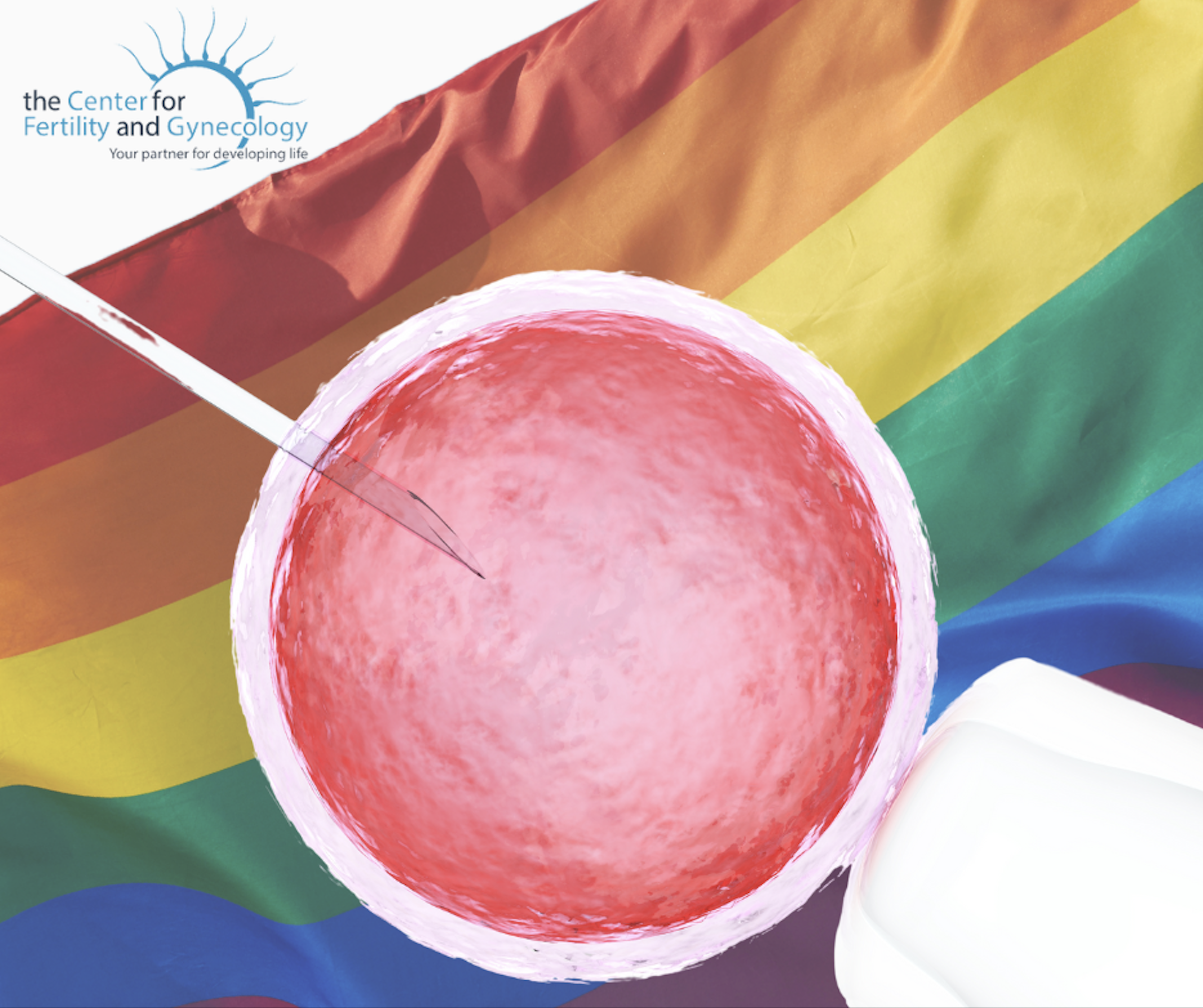 reciprocal IVF for the LGBTQ community